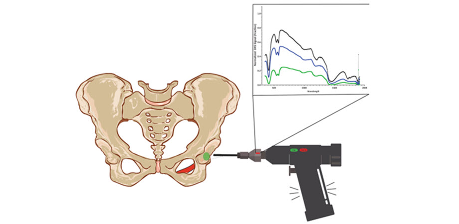 Concept of a smart optical drill for total hip arthroplasty